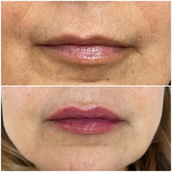 Harmoni Lips